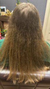 split ends treatment